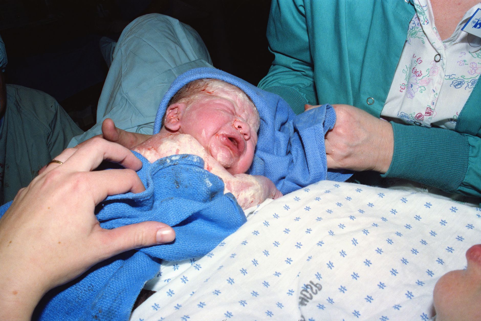 Ilustrasi: A newborn baby immediately after birth being wrapped in a hospital delivery room.
